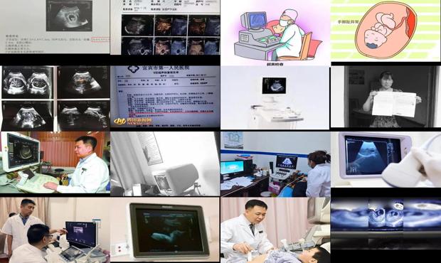 汕头b超是检查什么的