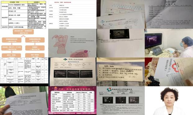 汕头乳腺检查费用
