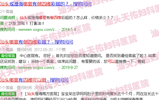 汕头哪里可以做四维