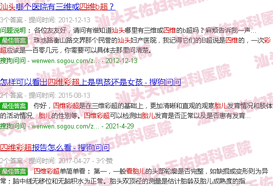 汕头四维彩超看胎儿