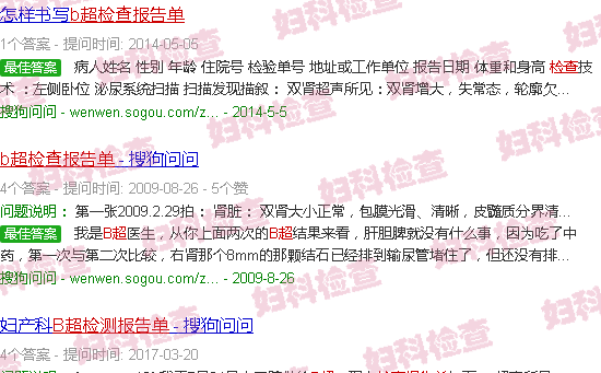汕头b超检查报告单