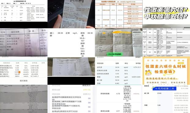 汕头六项激素检查多少钱