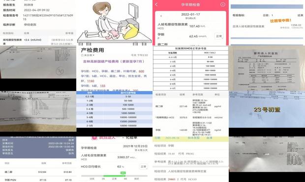 汕头hcg检查多少钱