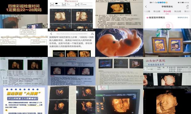 汕头四维彩超*佳时间