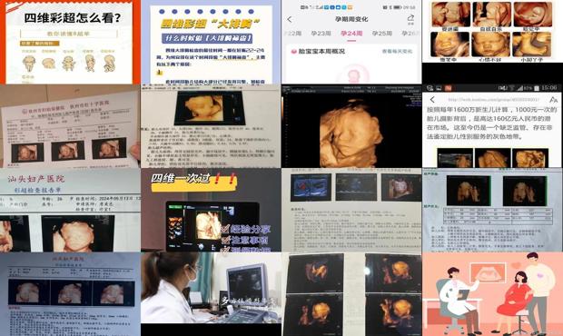 汕头四维彩超的*佳时间