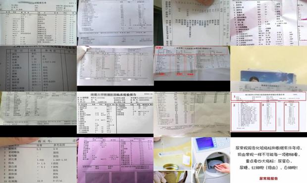 汕头尿常规主要检查什么