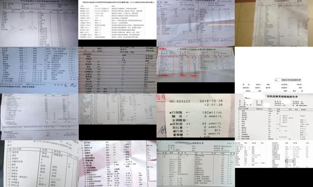 汕头尿常规检查结果分析