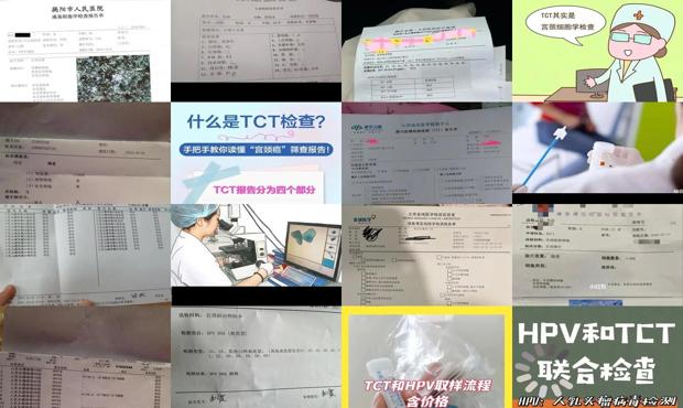 汕头tct检查