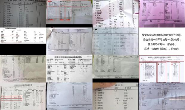 汕头尿常规检查医院 - 汕头尿常规能检查出什么
