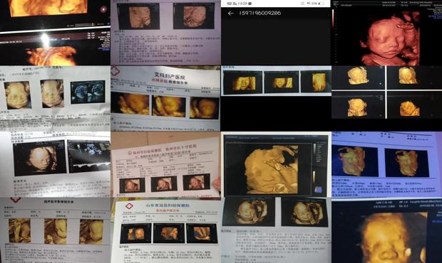 汕头6个月胎儿四维彩超