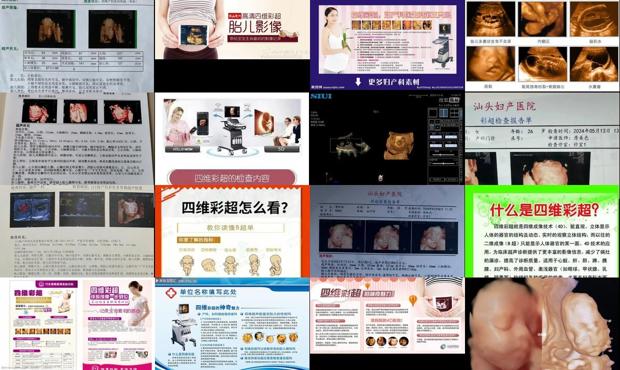 汕头四维彩超的好处