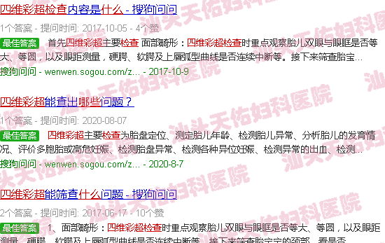 汕头四维彩超都检查什么