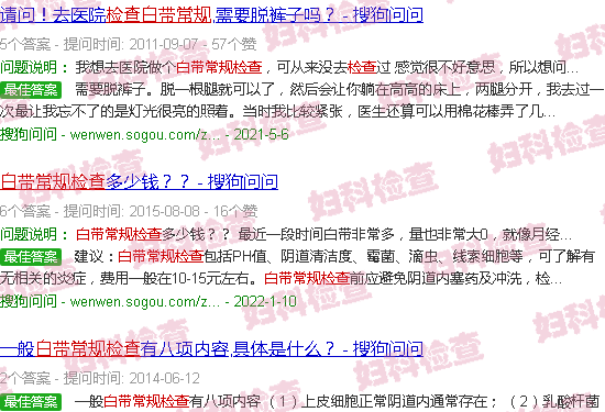 汕头检查白带常规