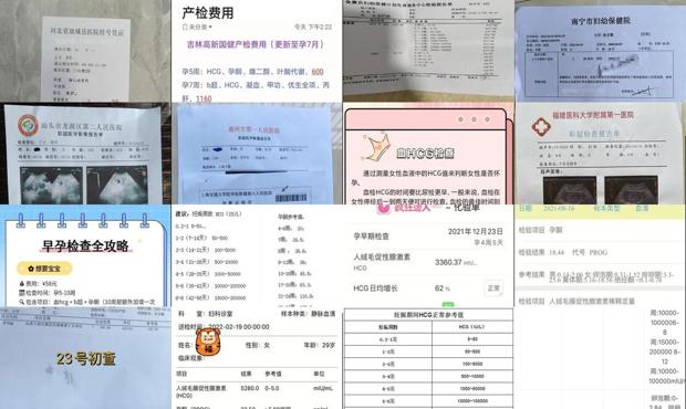 汕头血hcg检查多少钱
