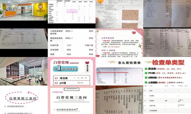 汕头白带常规怎么检查