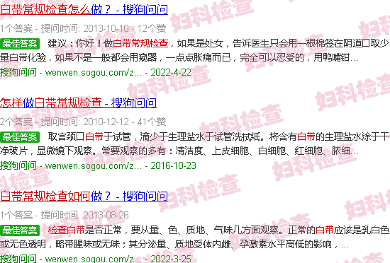 汕头白带常规怎么检查