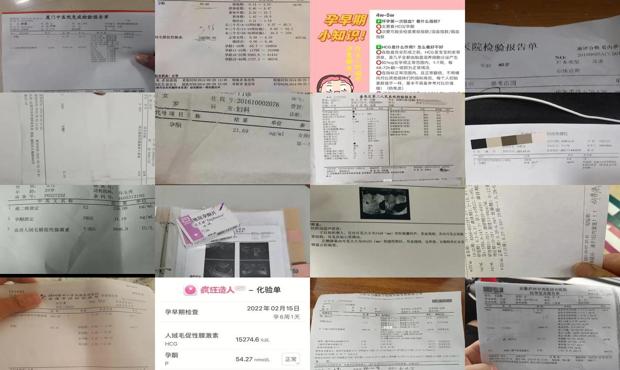 汕头孕酮是检查什么的