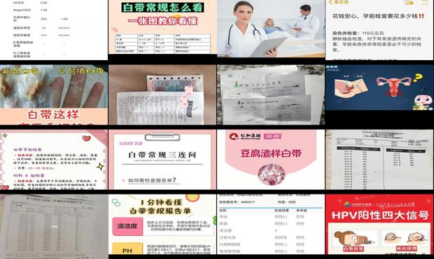 汕头白带检查多少钱