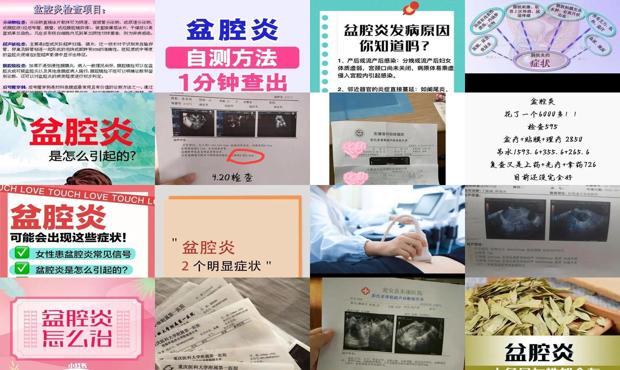 汕头盆腔炎怎么检查
