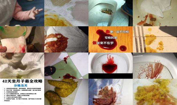 汕头坐月子大便出血怎么办