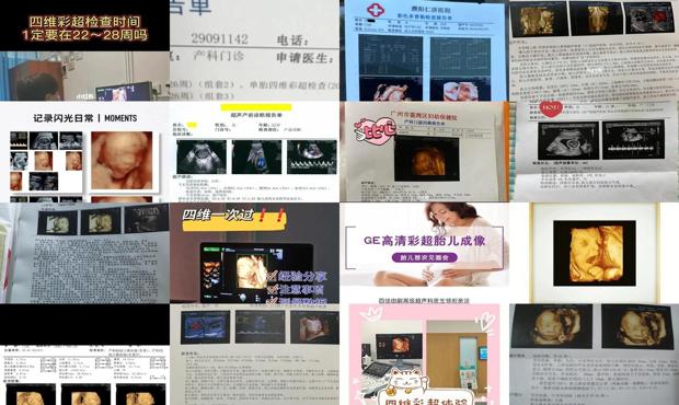 汕头四维彩超多少周做好