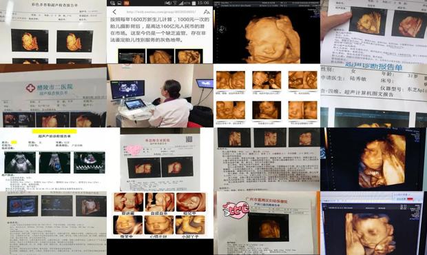 汕头孕妇几周做四维