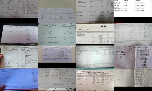 汕头激素六项检查