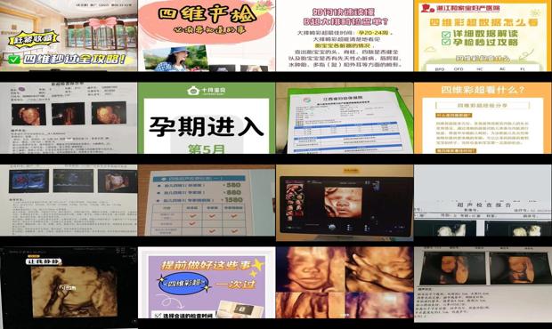 汕头一般做四维彩超多少钱