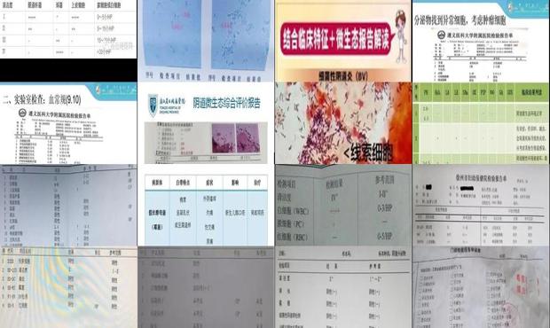 汕头阴道分泌物常规检查
