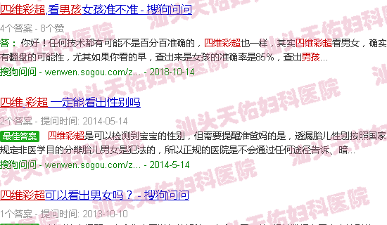 汕头怀男孩四维彩超