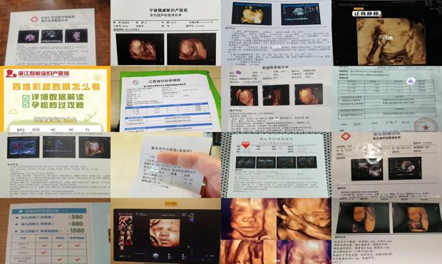 汕头四维彩超一般多少钱
