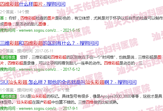 汕头四维彩超图片