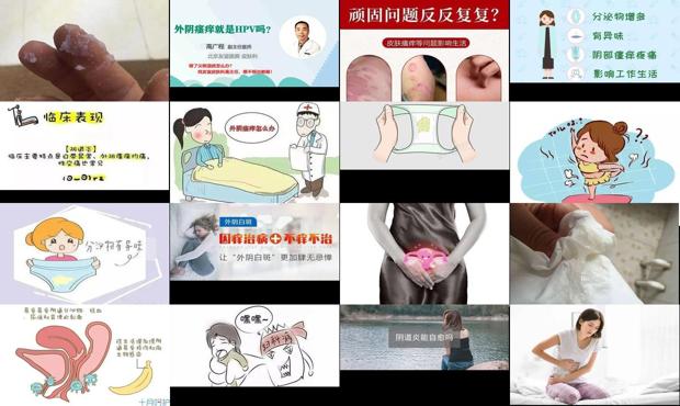 汕头外阴瘙痒会导致不孕吗
