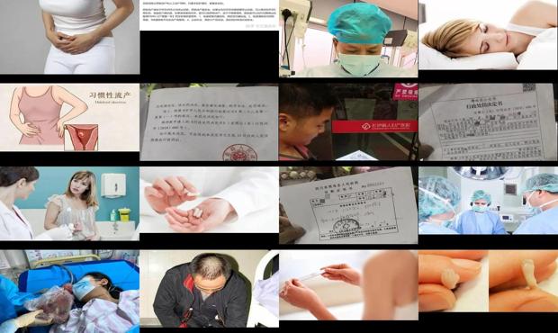 汕头怀孕一个月可以吃药流产吗