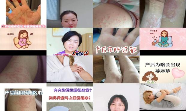 汕头坐月子下面痒怎么回事