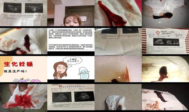 汕头流产一个月了没来月经