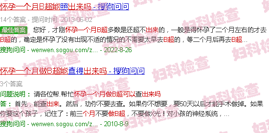 汕头怀孕一个月做b超能检查出来吗