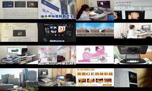 汕头哪个医院做四维好