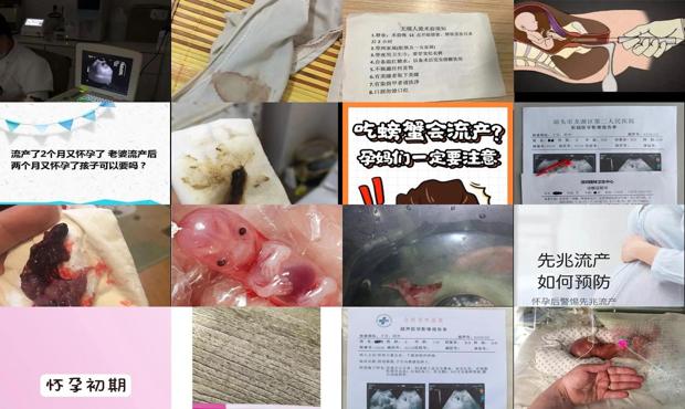 汕头刚流产又怀孕了