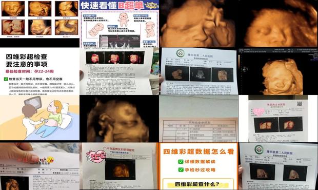 汕头孕妇四维彩超几个月做