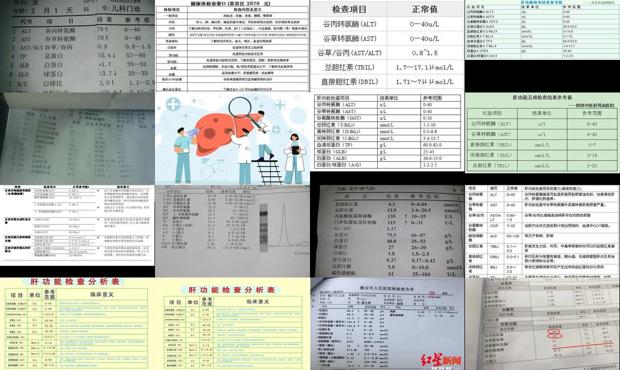 汕头医院检查肝功能多少钱