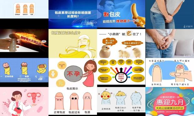 汕头包皮会不会导致不孕