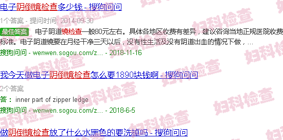 汕头阴倒镜检查的费用