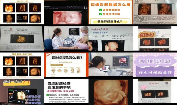 汕头做四维的*佳时间