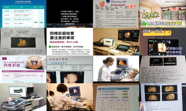 汕头做四维彩超价格