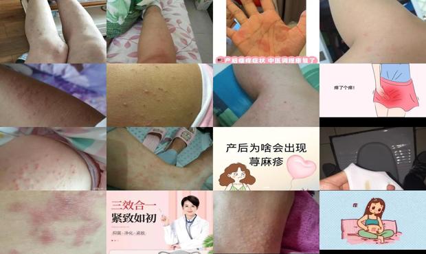 汕头做月子下面痒怎么回事