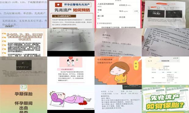 汕头先兆流产保胎成功*
