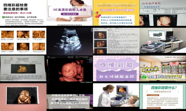 汕头什么时候做四维彩超*好