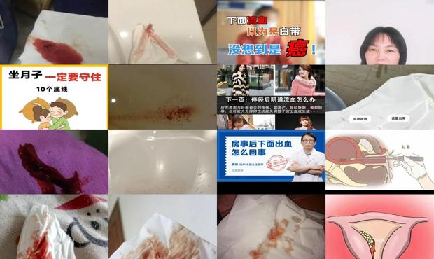 汕头坐月子同房下面流血是怎么回事