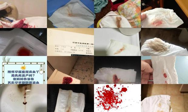汕头怀孕出血多少是流产了